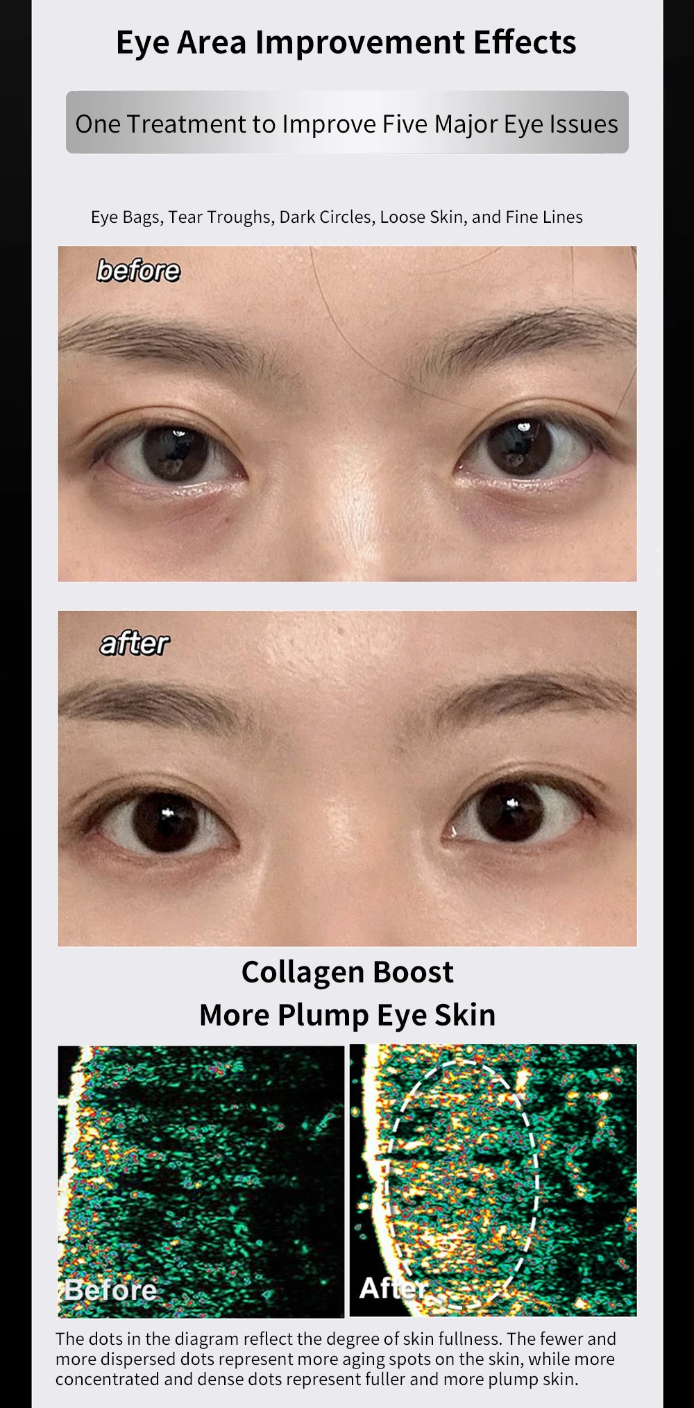 Ems Eye Face Beauty Massage Muscle Stimulator Facial Lifting Anti-Wrinkle Lift Face Skin Care Dark Circles Relieves Fatigue