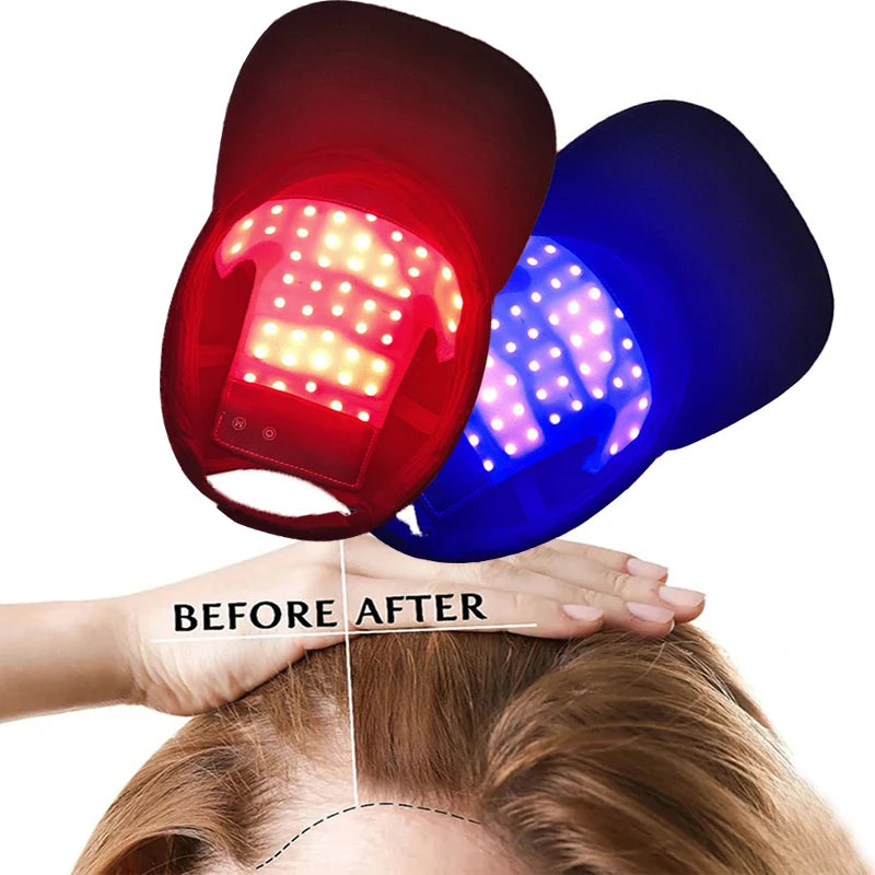 LED Red Light Therapy Cap Hair Growth Helmet Diode LaserHat Light Therapy Cap for Hair Regrowth and Hair Loss Treatment