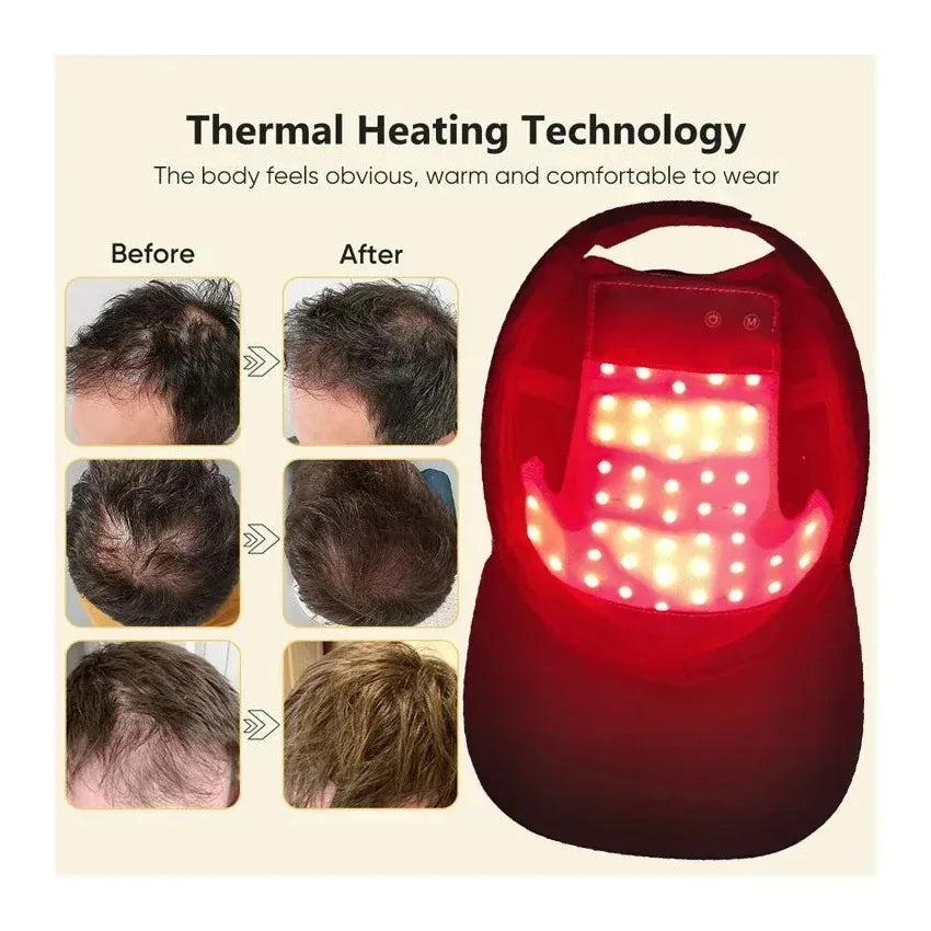 LED Red Light Therapy Cap Hair Growth Helmet Diode LaserHat Light Therapy Cap for Hair Regrowth and Hair Loss Treatment