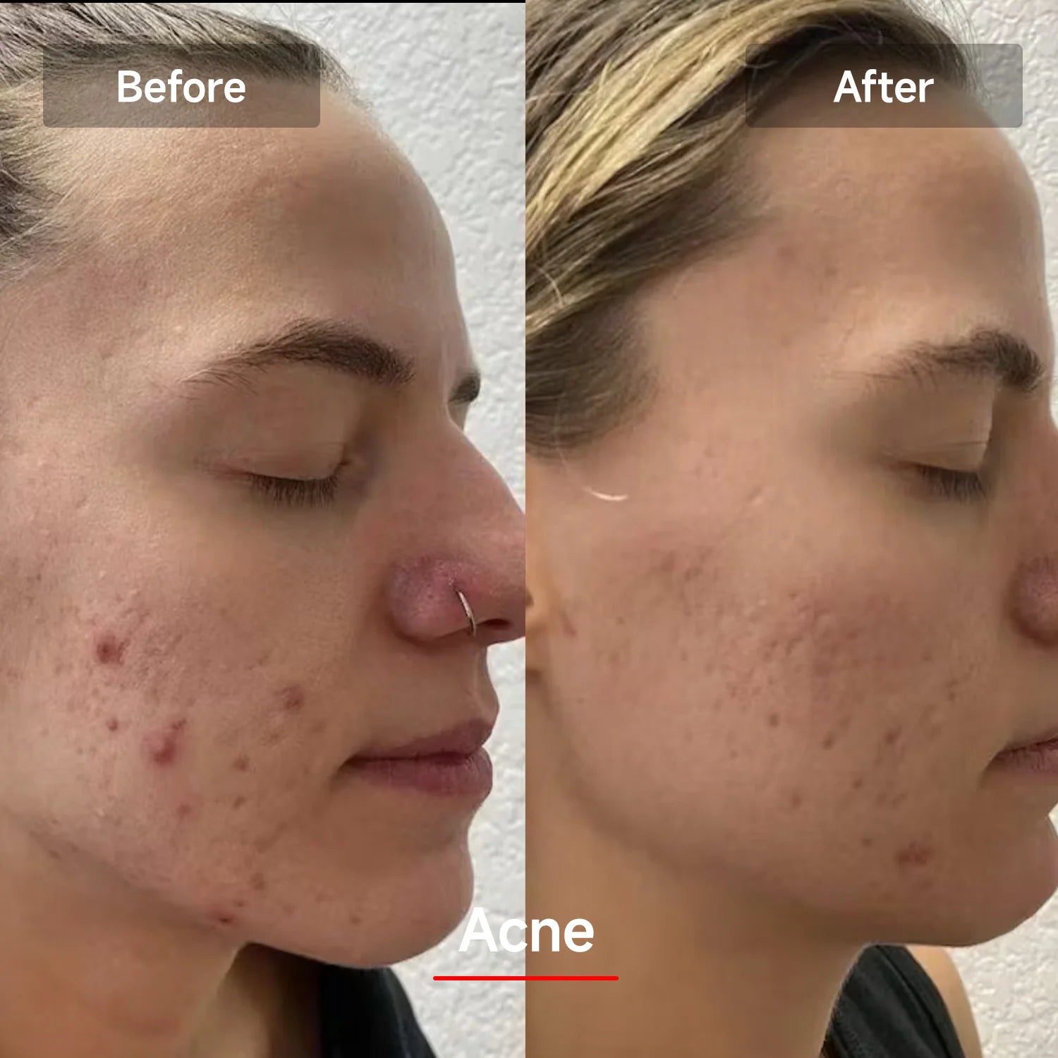 LED Red Light Therapy Face Mask